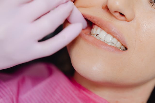 Dental Accidents