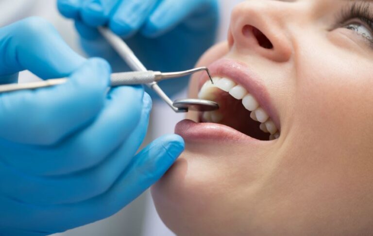 Dental Checkups