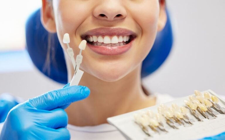 teeth bleaching Torrance