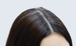 Gray Hair