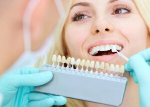 teeth whitening