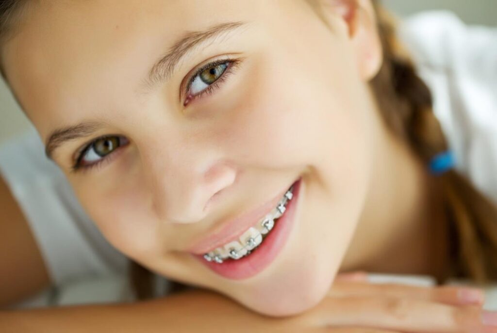 orthodontist in Carmel