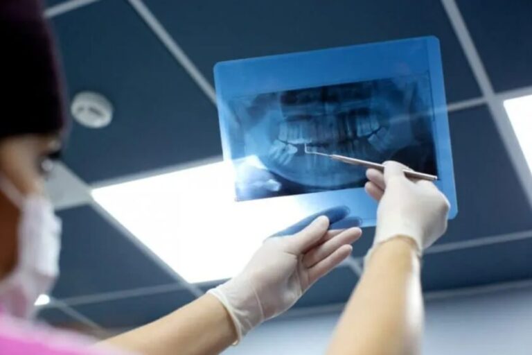 Dental X Rays
