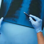 X-Ray
