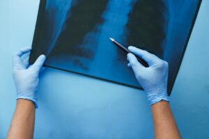 X-Ray