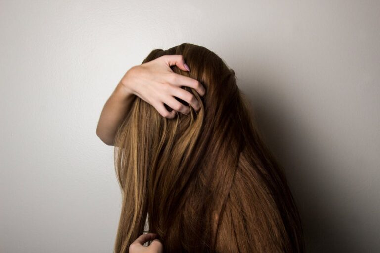 PCOS Hair Loss