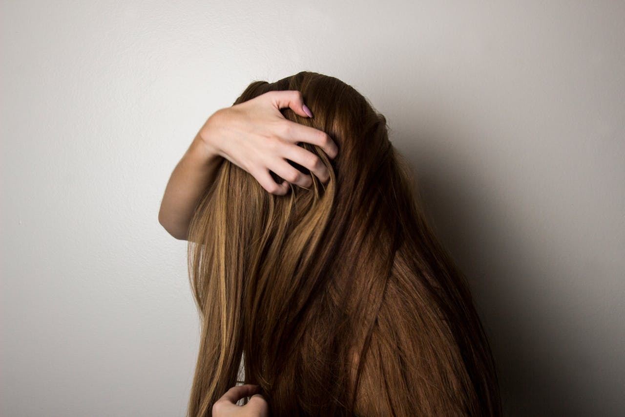 PCOS Hair Loss