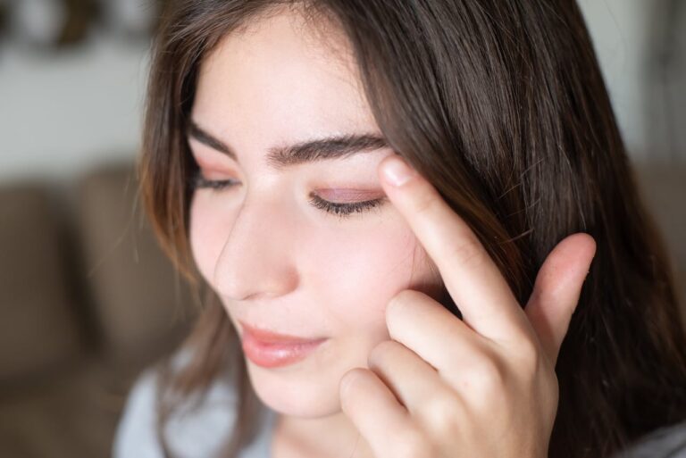 Adult Acne