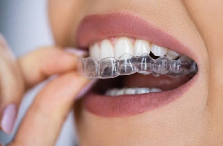 dental health