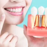 Dedham tooth implant