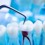 Brentwood endodontics