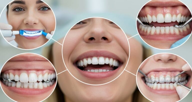 Cosmetic Treatments dental