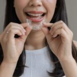 clear aligners in Buckhead, Atlanta