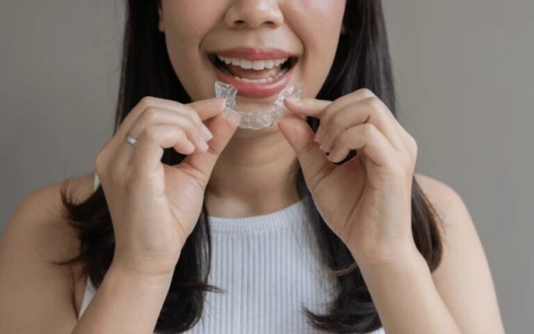 clear aligners in Buckhead, Atlanta
